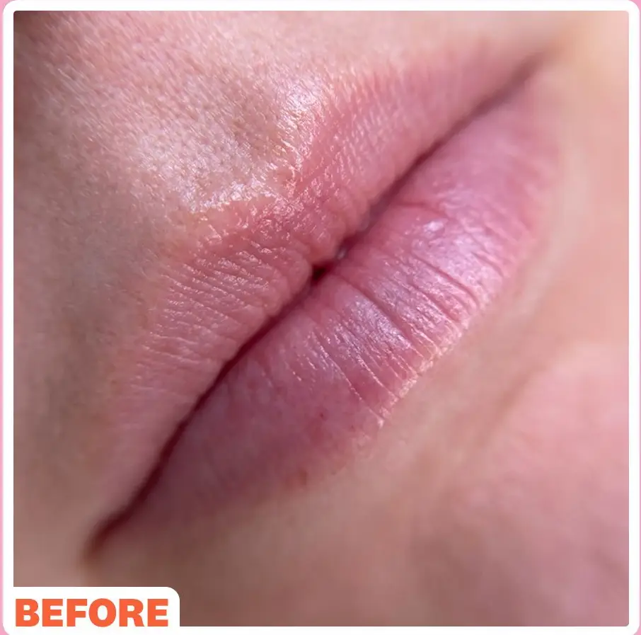 wh-index-beauty-beforeandafter2-lipblushing-1675121399