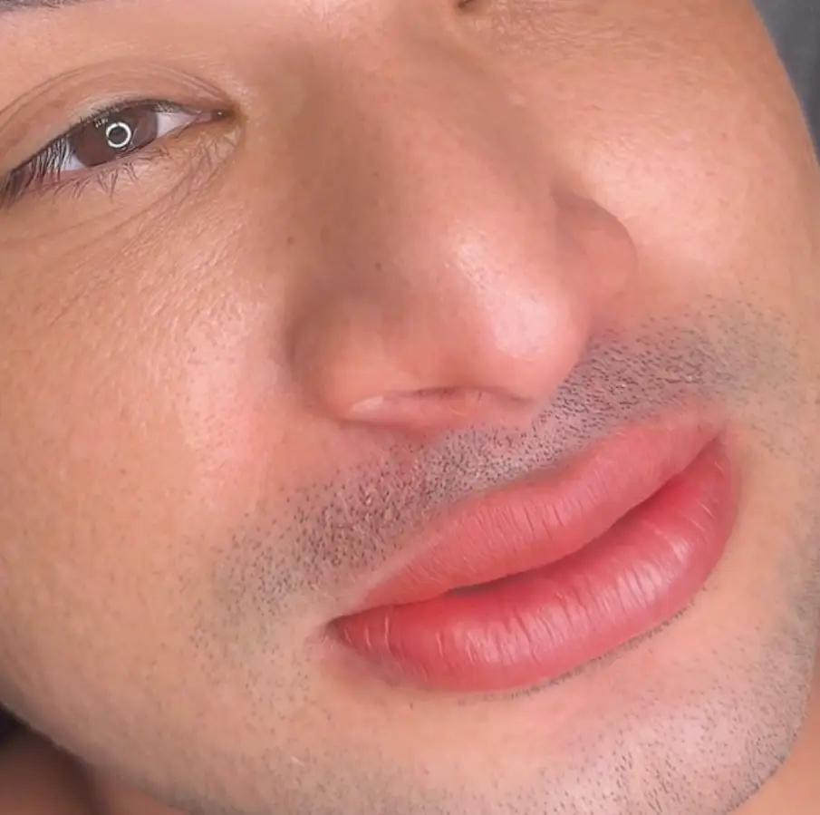 Lips (1)