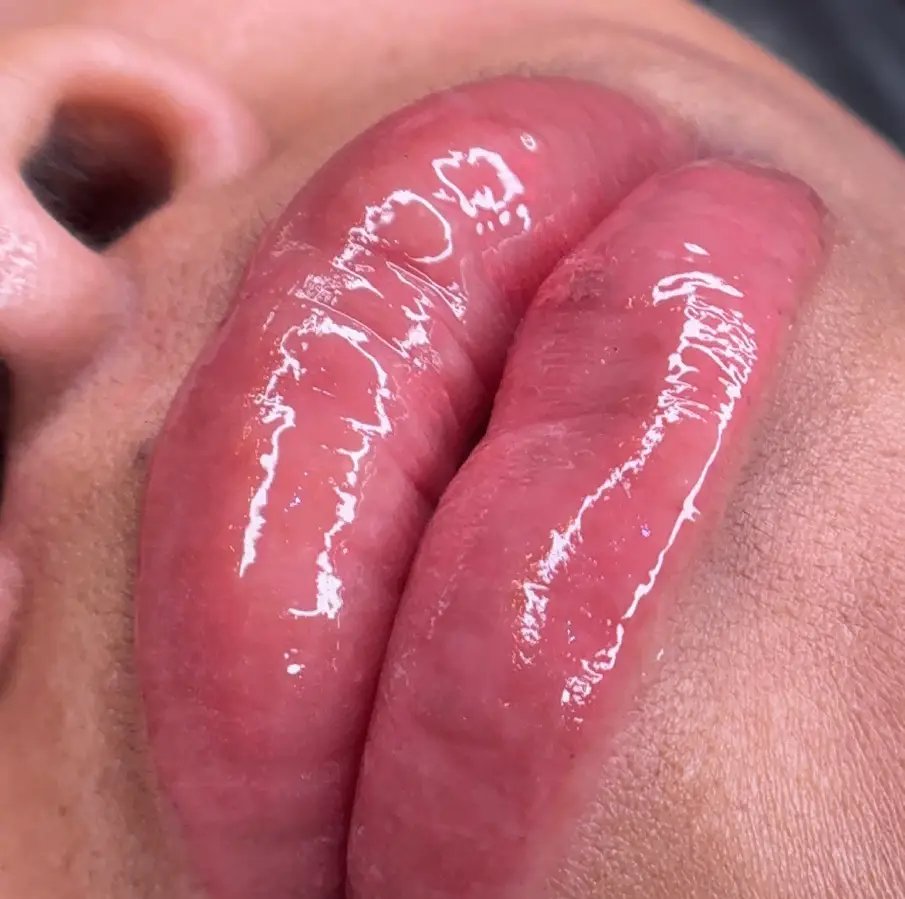 Lips (2)