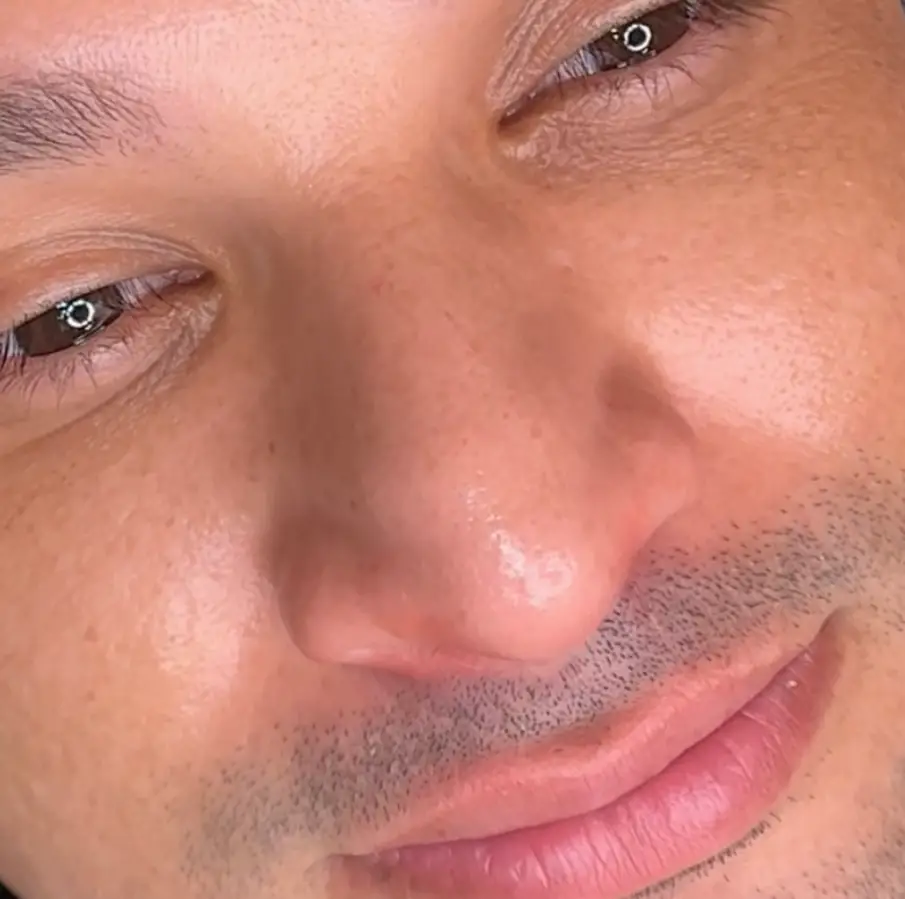 Lips